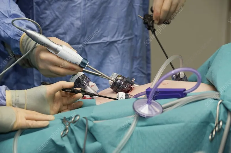 Minimal Access, Bariatric & General Surgery