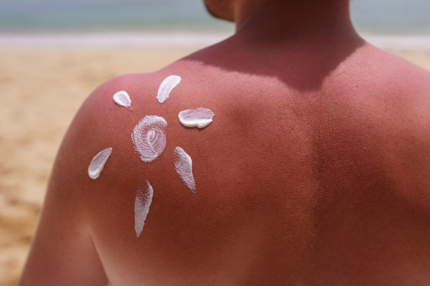 How to Protect Your Skin from Harmful UV Rays