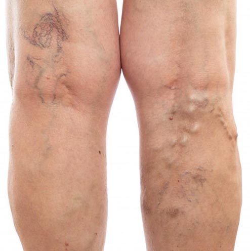 Vein Clinic